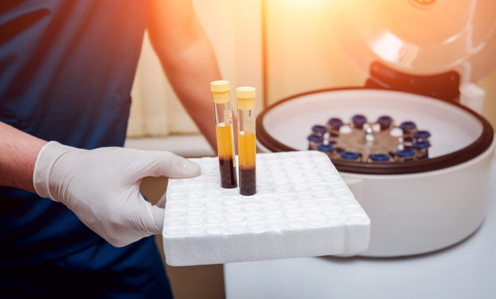 Blood tubes and centrifuge